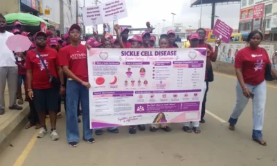 sickle cell