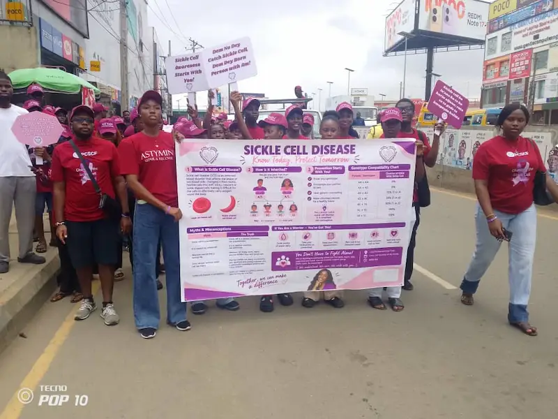 sickle cell